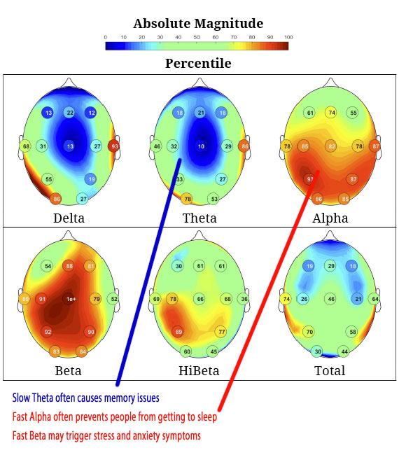 brain map report01 Fort Wayne - Brain Map Report01 