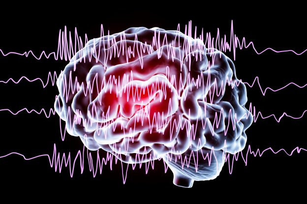 Epilepsy: Frequently Asked Questions